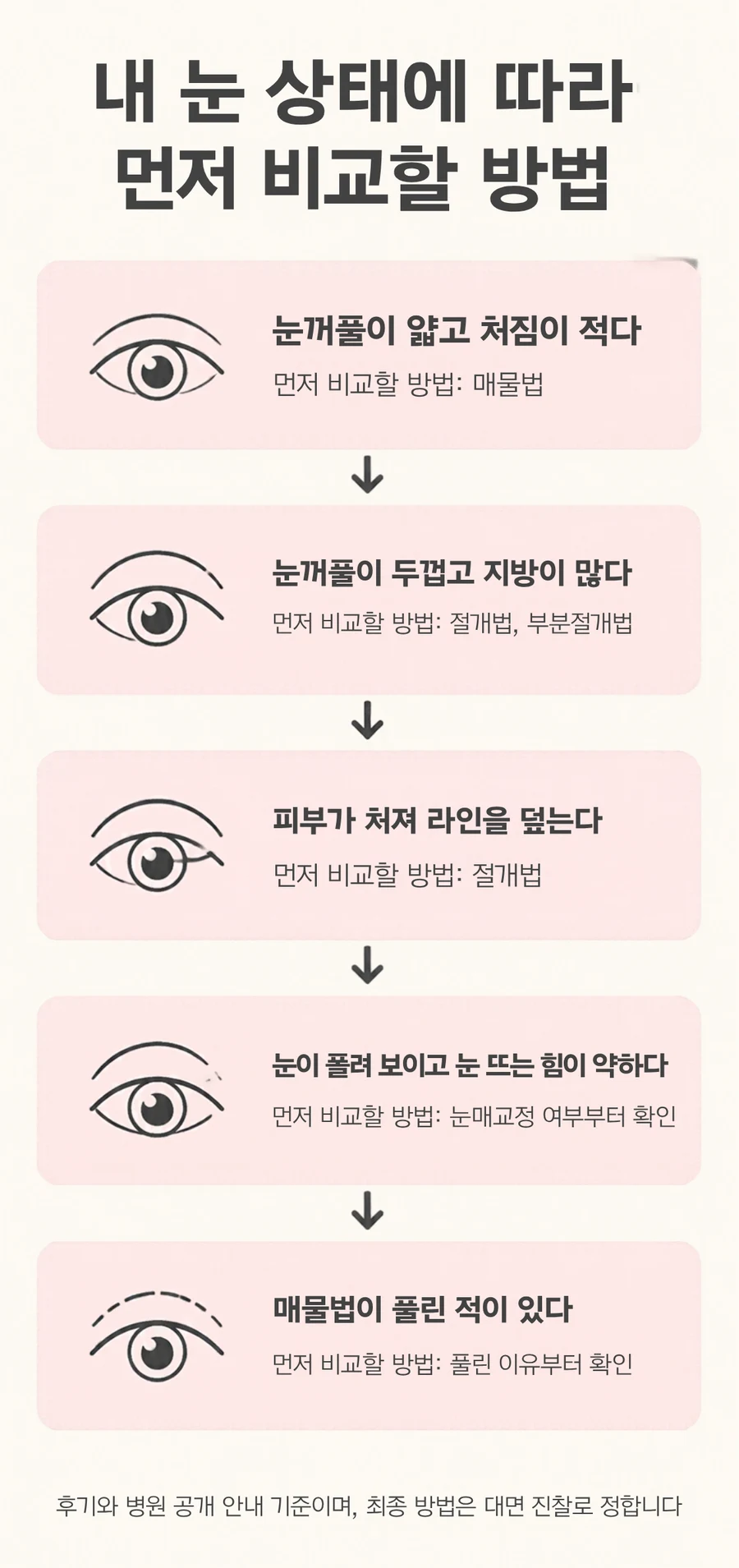 눈꺼풀이 얇고 처짐이 적은 눈은 매몰법, 두껍고 지방이 많은 눈은 절개법이나 부분절개법, 피부가 처져 라인을 덮는 눈은 절개법, 졸려 보이고 눈 뜨는 힘이 약한 눈은 눈매교정 여부, 매몰법이 풀린 적이 있는 눈은 풀린 이유를 먼저 확인하도록 다섯 가지 눈 상태별로 나눈 선택 흐름 그림
