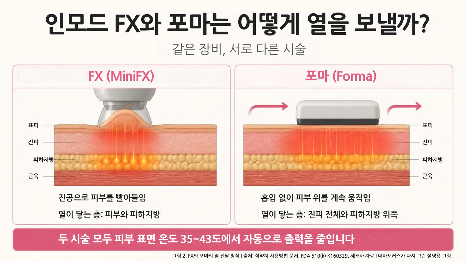피부 단면에서 FX는 진공으로 피부를 빨아올려 피부와 지방층에 열을 보내고, 포마는 흡입 없이 피부 위를 움직이며 진피 전체와 피하지방 위쪽에 열을 보내는 모습을 나란히 그린 인모드 시술 비교 그림