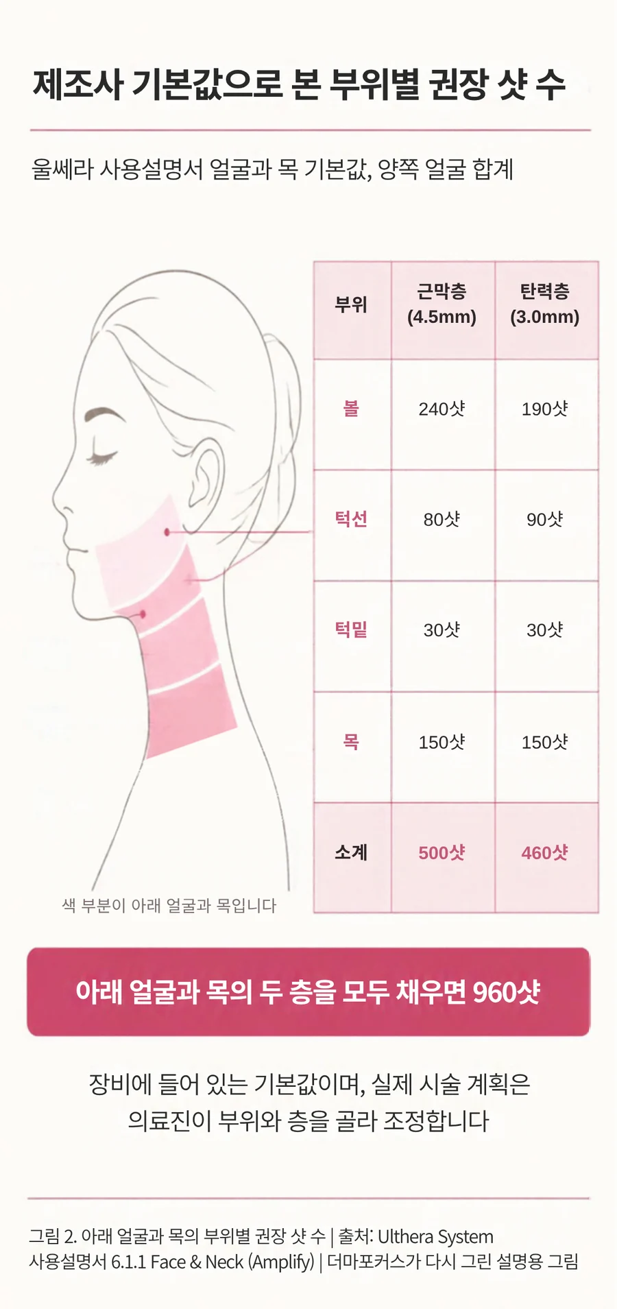 옆얼굴 그림에서 볼, 턱선, 턱밑, 목을 분홍색으로 칠하고, 근막층(4.5mm)과 탄력층(3.0mm)의 부위별 권장 샷 수를 표로 정리해 합계 960샷을 표시한 울쎄라 샷 배분 설명 그림